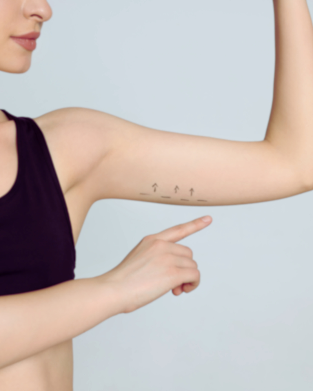 Lux Mesotherapy - Arms (6-weeks)