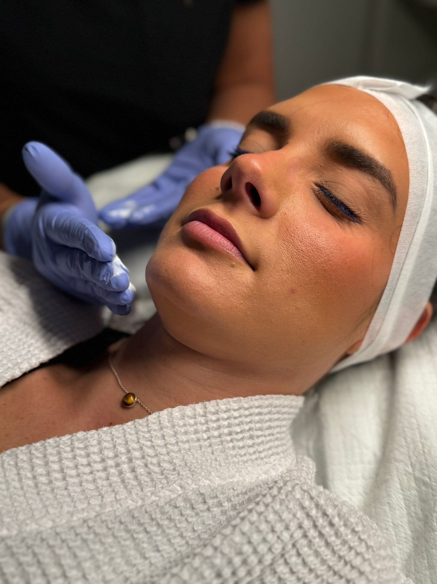 LUX Face SkinPen Microneedling 5 Pack