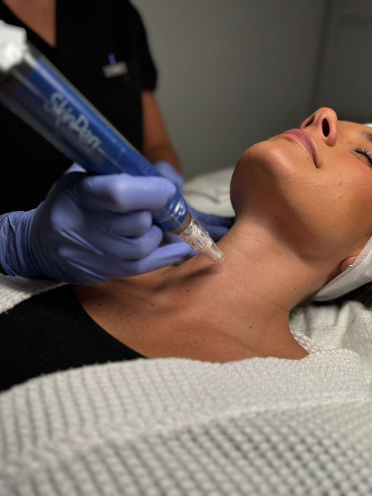 LUX Face, Neck and Chest SkinPen Microneedling + PRP