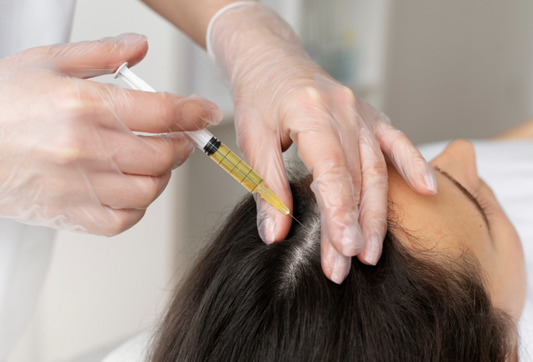 LUX Hair Loss With PRP